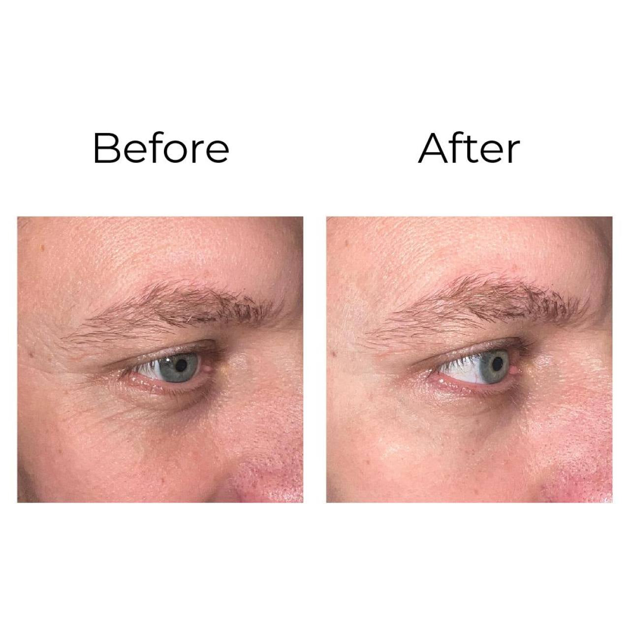 Peptilux – Anti-Falten Augencreme „Shock Action"-Effekt mit LIPHASYN™ - 20 ml
